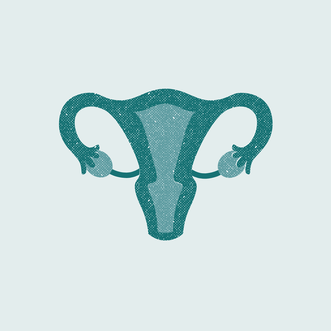 L'endométriose de A à Z ostéopathe