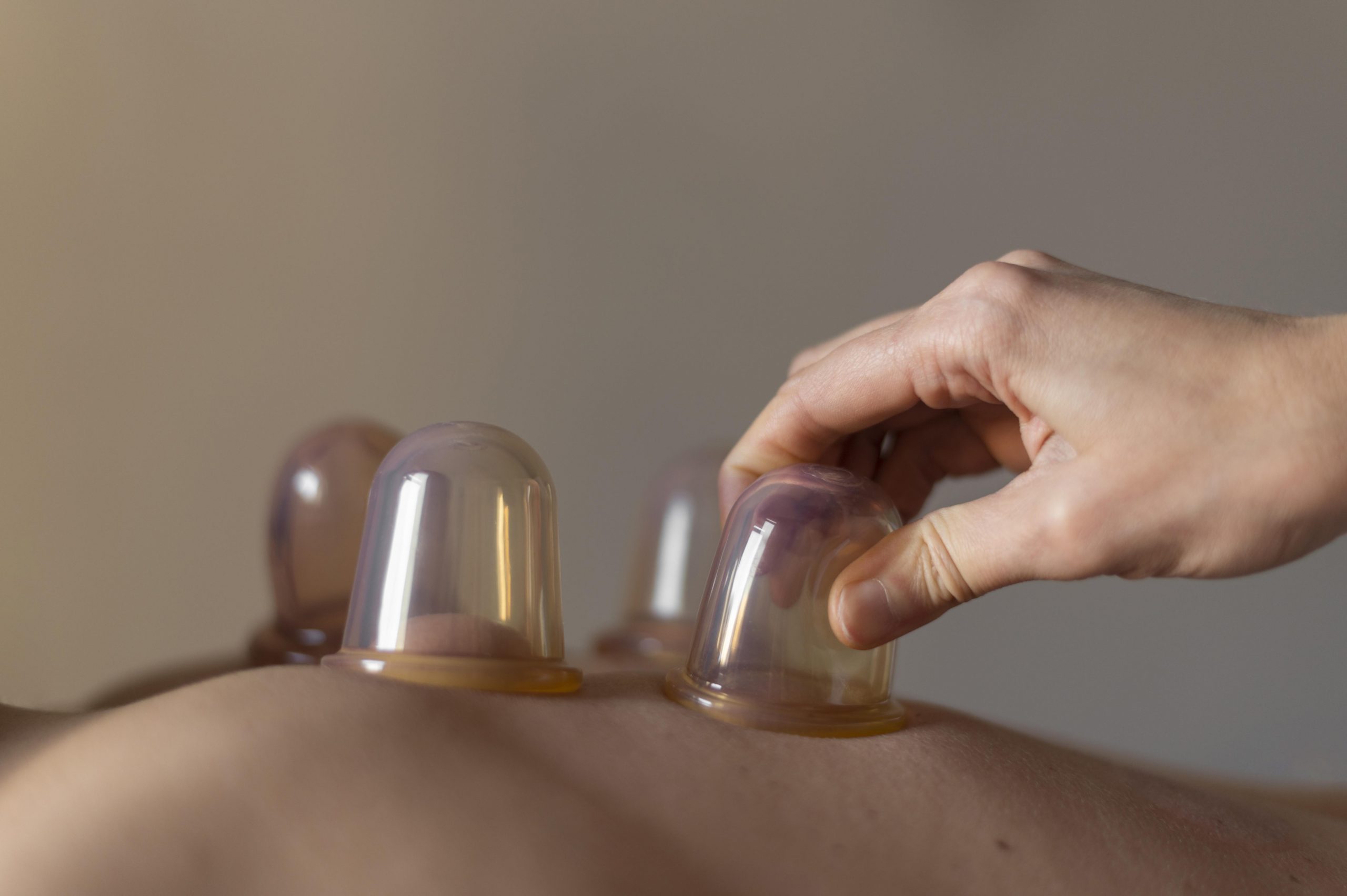 cupping image de https://fr.freepik.com/